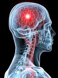 Sensory Processing Disorder