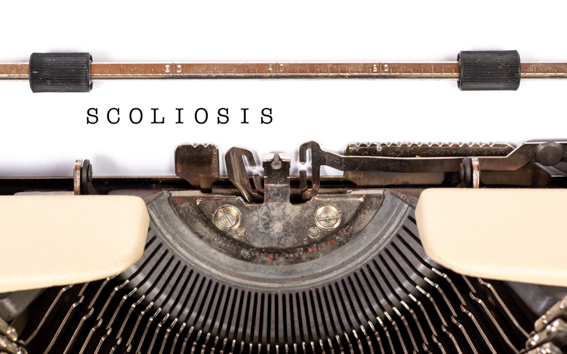 A Typewriter With The Words Scoliosis Typed On A Piece Of Paper