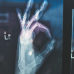 X-Ray Of Hand Making The OK Signal Signifying Good Health