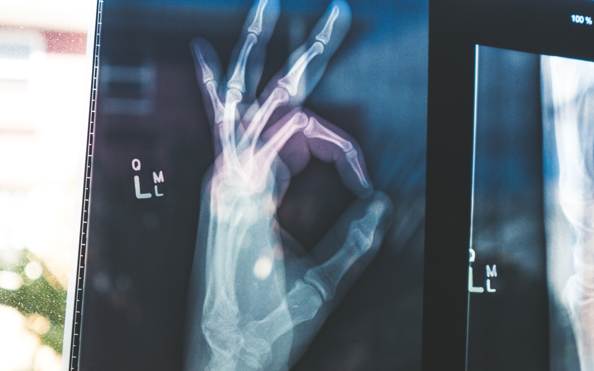 X-Ray Of Hand Making The OK Signal Signifying Good Health